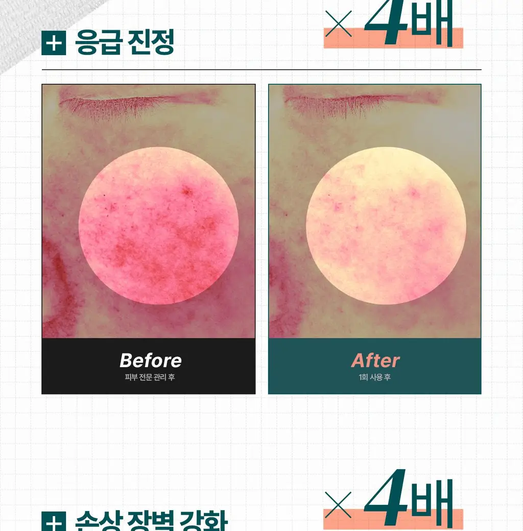 [4배속_응급진정/장벽강화]리쥬덱스 더마 리페어링 크림 20g(단품/기획) 상세페이지 5